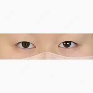 アリエル美容クリニック 大宮院口コミ