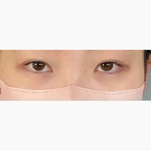 アリエル美容クリニック 大宮院口コミ