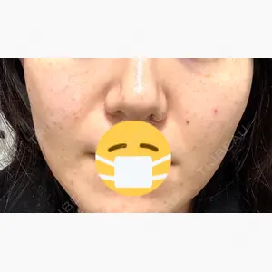 ライズワン美容皮膚科クリニック口コミ