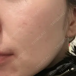 トラスト美容クリニック 銀座院口コミ