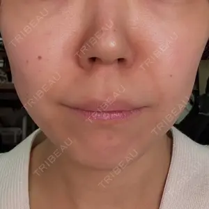 池袋美容クリニック口コミ