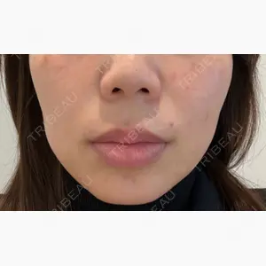 Tokyo Tensei Clinic 大阪梅田院口コミ