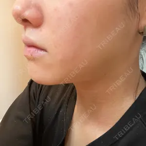 ビューティー和心クリニック 浅草院口コミ