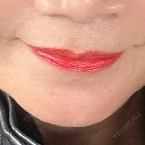 博多美容外科/美容皮膚科 ビラビューティークリニック口コミ