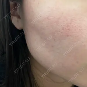 DAILY SKIN CLINIC 新宿院口コミ