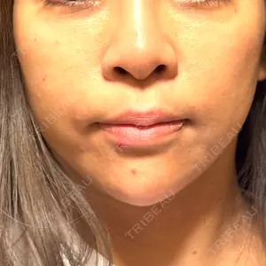 A CLINIC（エークリニック） 大阪院口コミ