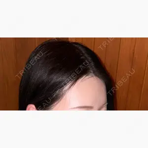 PRISM Beauty Clinic 新宿院口コミ