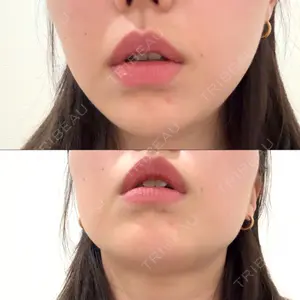 美容皮膚科ティファクリニック 新宿東口口コミ