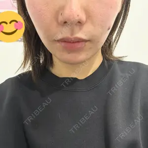 ルラ美容クリニック 渋谷本院口コミ