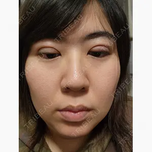 アリエル美容クリニック 郡山院口コミ