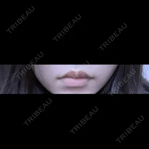 ルラ美容クリニック 名古屋栄院 / ルラスキンクリニック 名古屋栄院口コミ