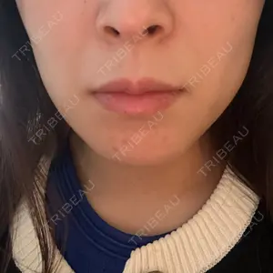 TCB東京中央美容外科 宇都宮院口コミ