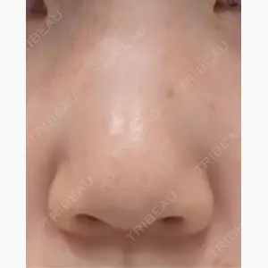 Tokyo Tensei Clinic 新宿院口コミ