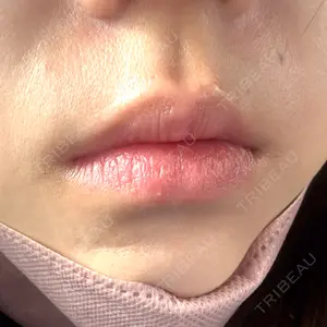 ルラ美容クリニック 大阪心斎橋院口コミ