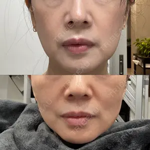共立美容外科 大分院口コミ