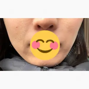 名駅なぎクリニック口コミ