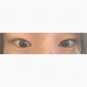 TCB東京中央美容外科 小倉院口コミ