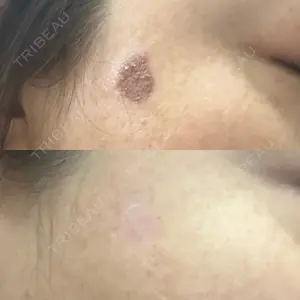 S-Laboクリニック 渋谷院口コミ