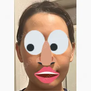 PureMe Skin Clinic（ピュアミースキンクリニック麻布）口コミ