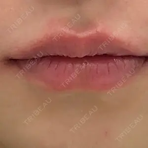 ルラ美容クリニック 名古屋栄院 / ルラスキンクリニック 名古屋栄院口コミ