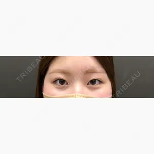 YBC横浜美容外科 池袋院口コミ