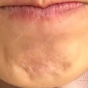 湘南美容クリニック 金山院口コミ