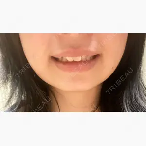 L‘amour clinic Tokyo【ラムールクリニック東京】口コミ