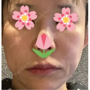 ゆきスキンクリニック 東池袋口コミ