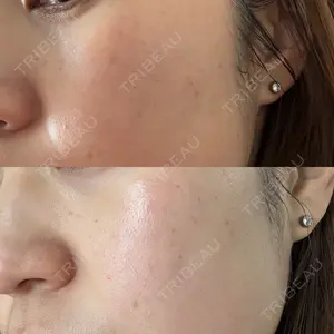 ルラ美容クリニック 大宮院 / ルラスキンクリニック 大宮院口コミ