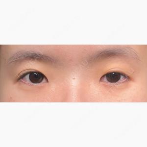 HAAB×DREAM BEAUTY CLINIC 大阪梅田院口コミ