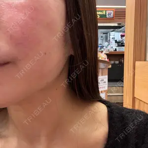 ライズワン美容皮膚科クリニック口コミ