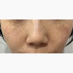 ルラ美容クリニック 池袋院口コミ