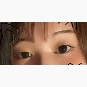 アリエル美容クリニック 郡山院口コミ