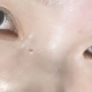 ルラ美容クリニック 上野院口コミ