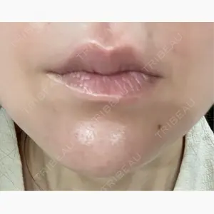 札幌美容外科ネビュラクリニック口コミ