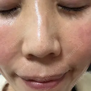 B-LINE CLINIC 池袋院口コミ