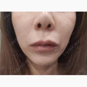 池袋美容クリニック口コミ