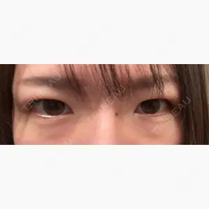 R Beauty CLINIC 銀座院口コミ