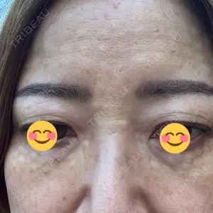 ルラ美容クリニック 郡山院口コミ