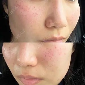 ルラ美容クリニック 町田院口コミ