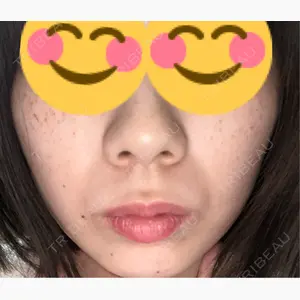 Days Beauty Clinic 新宿院口コミ