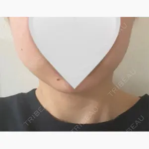 ライズワン美容皮膚科クリニック口コミ