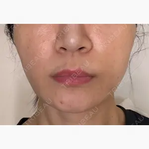 グレーススキンクリニック口コミ