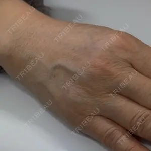 小暮整形外科・美容外科口コミ