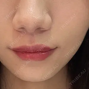 フィラークリニック 新宿院口コミ