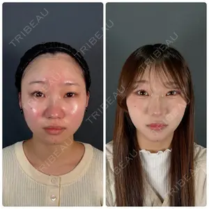 神戸美容外科 ネビュラクリニック口コミ