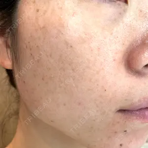 ルラ美容クリニック 千葉院 / ルラスキンクリニック 千葉院口コミ