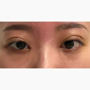 HAAB×DREAM BEAUTY CLINIC 東京本院口コミ