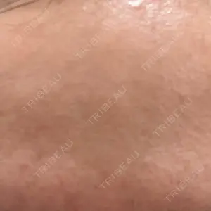 ゆきスキンクリニック 東池袋口コミ