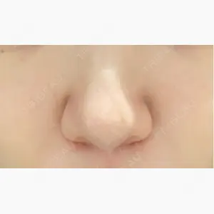 京都駅前美容外科口コミ